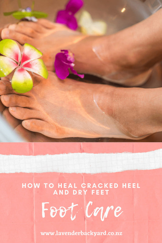 Foot Care | How to Heal Cracked Heel and Dry Feet?